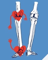 Illustrated bones with hearts
